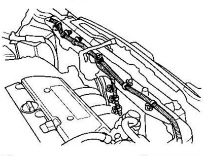 8. Снимите хомуты жгута.