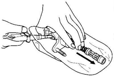 2. Осторожно вытолкните поршень, подав сжатый…